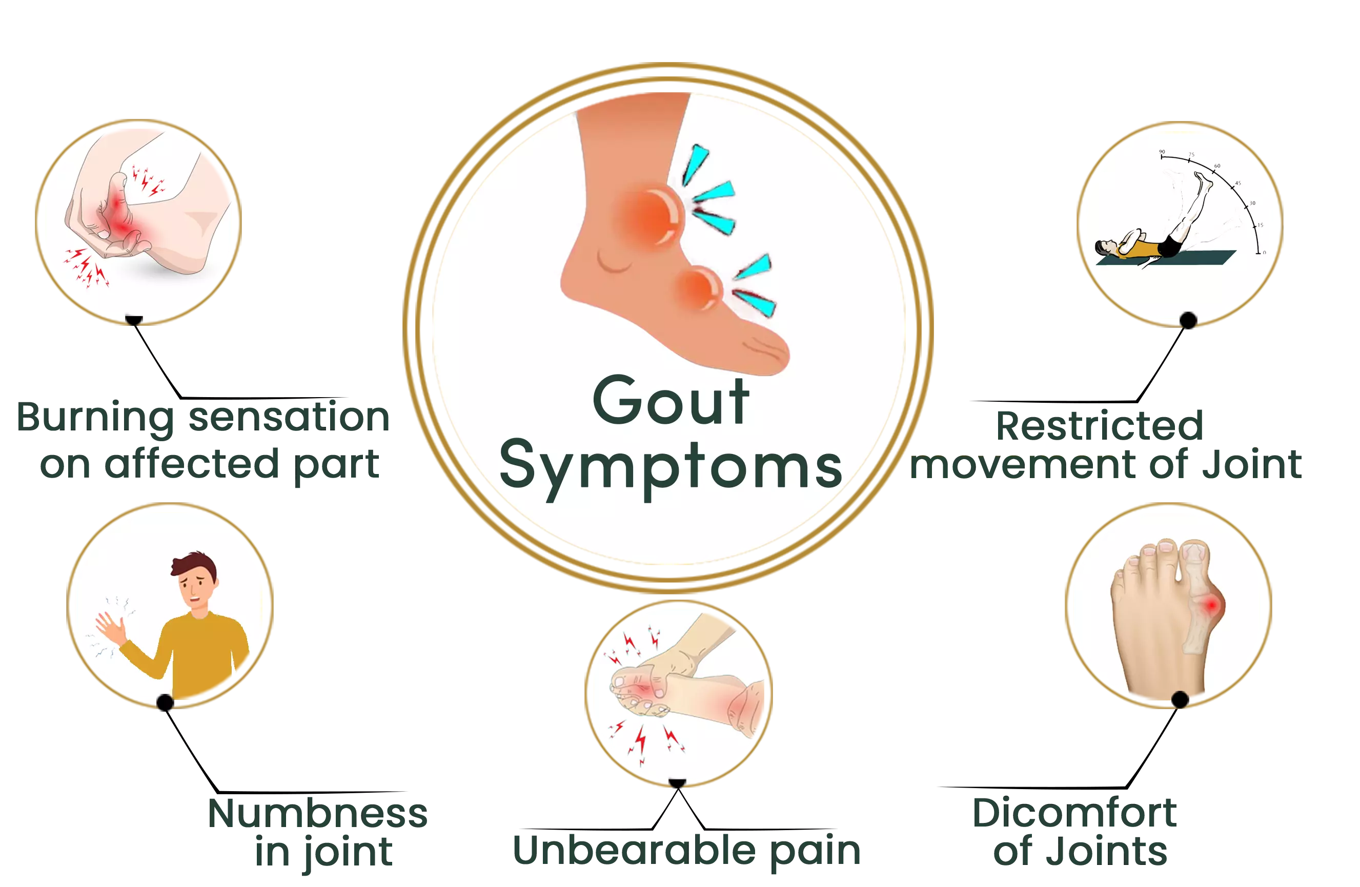 Gout Symptoms