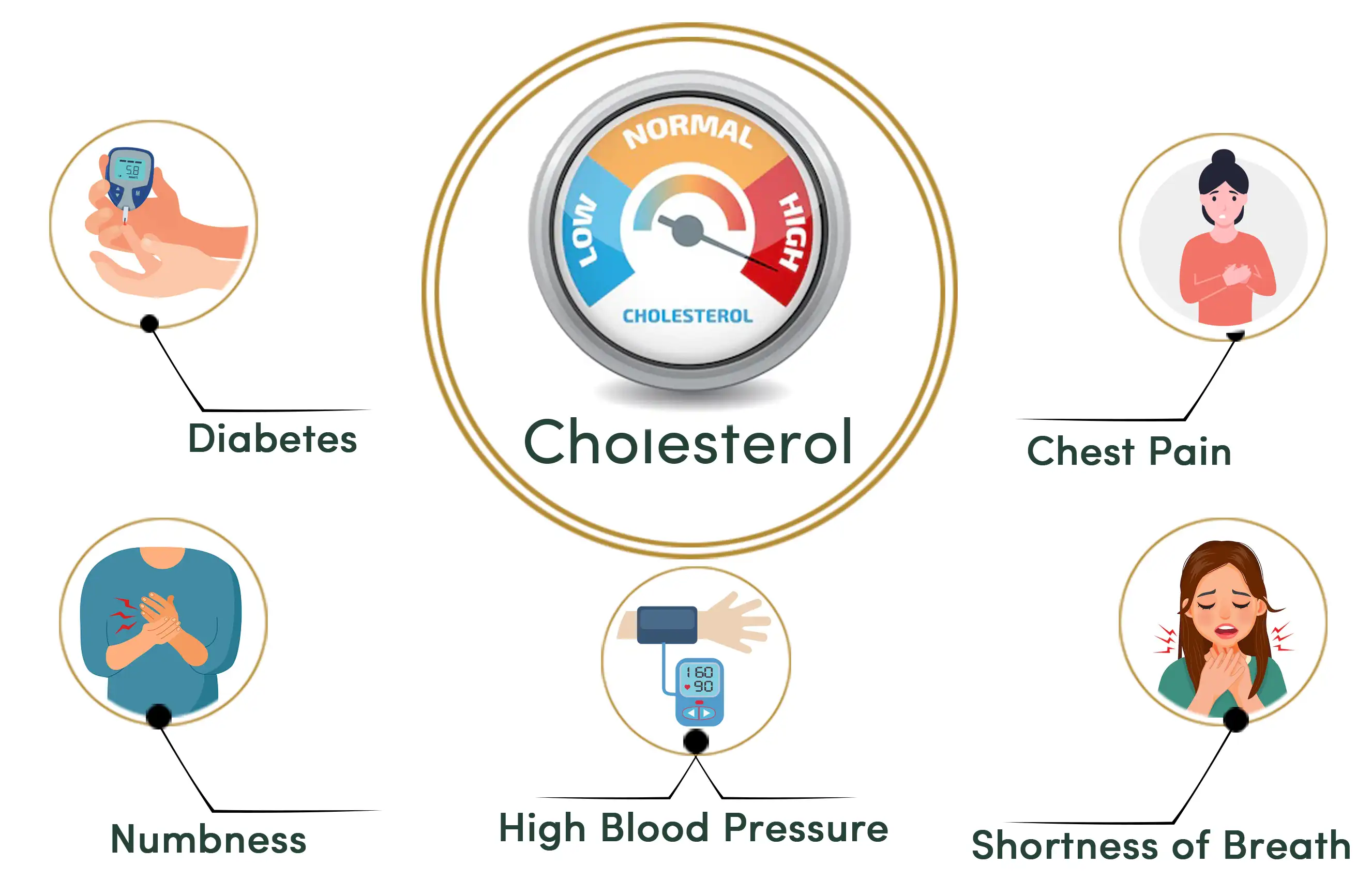 Complications of High Cholesterol