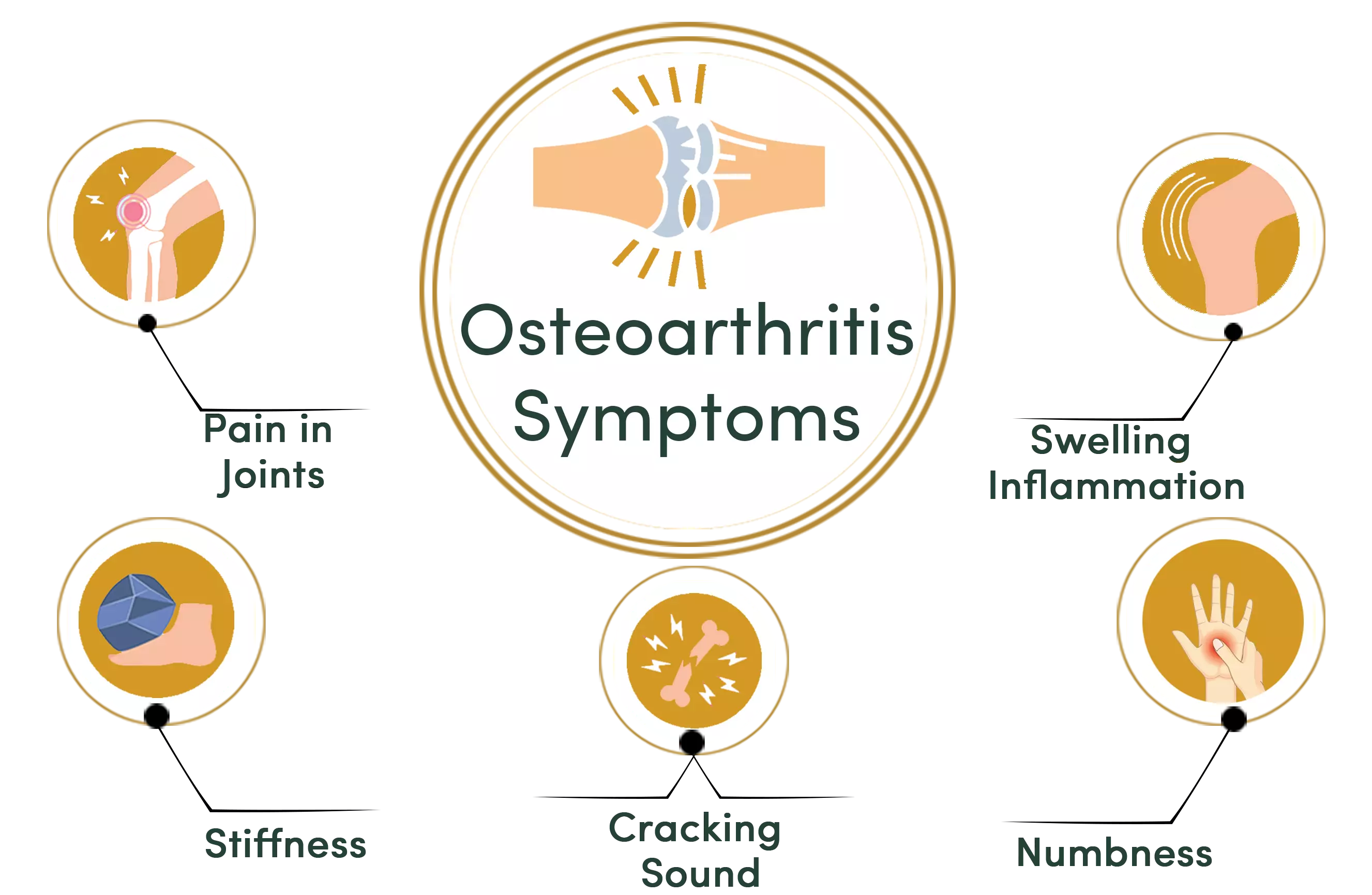 Osteoarthritis Symptoms