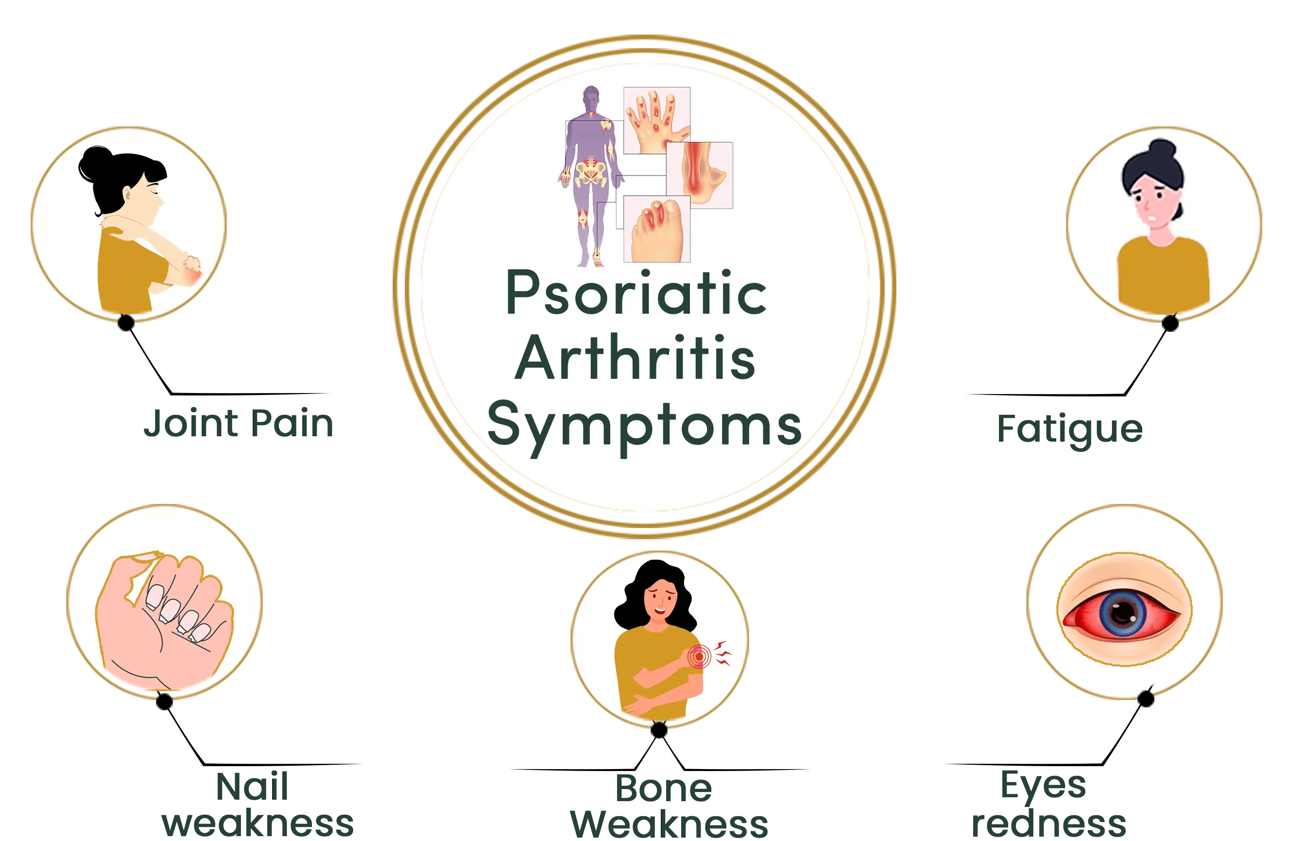 Psoriatic Arthritis symptoms