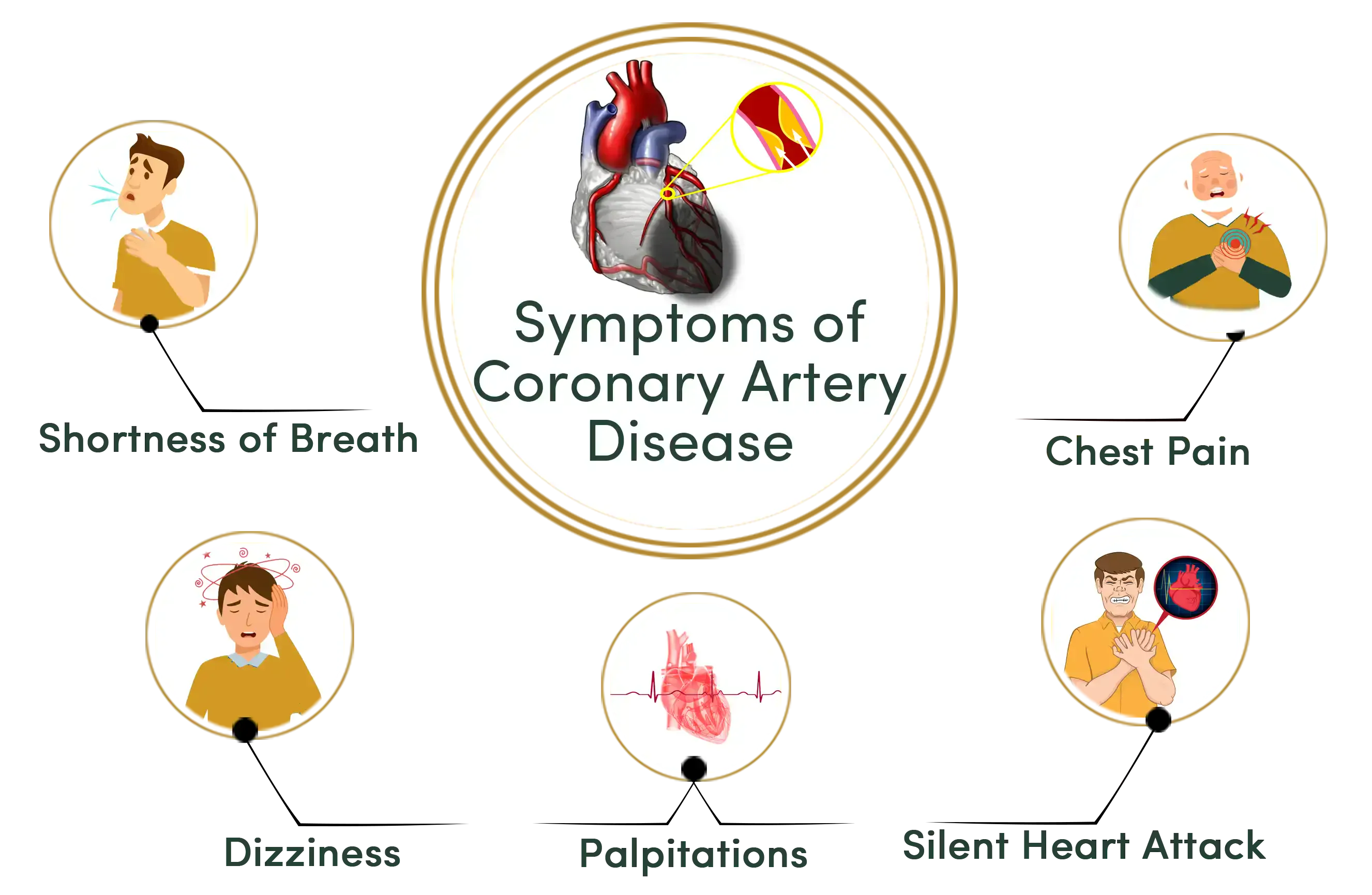 Symptoms of Coronary Artery Disease