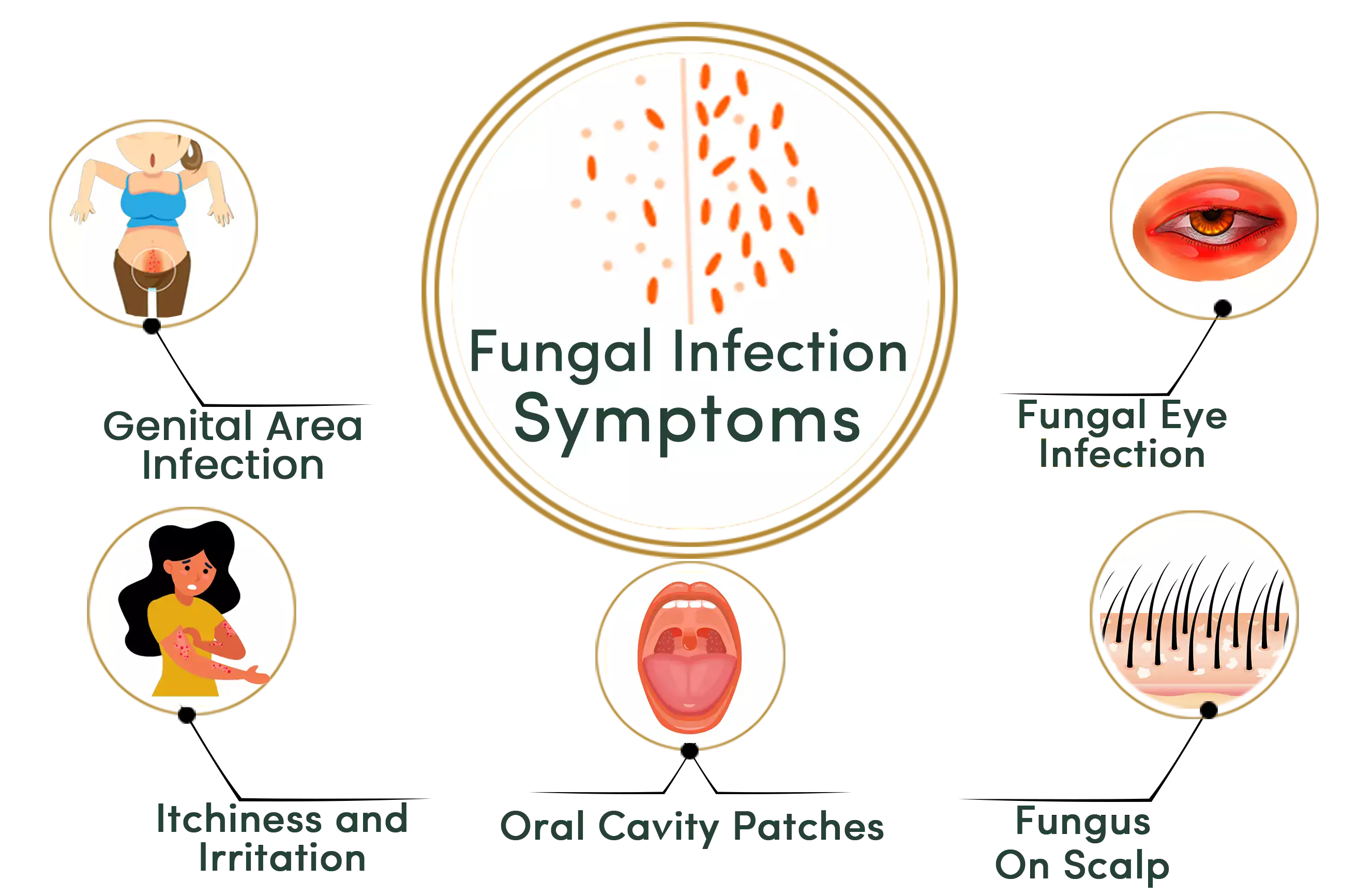 Fungal Infection symptoms