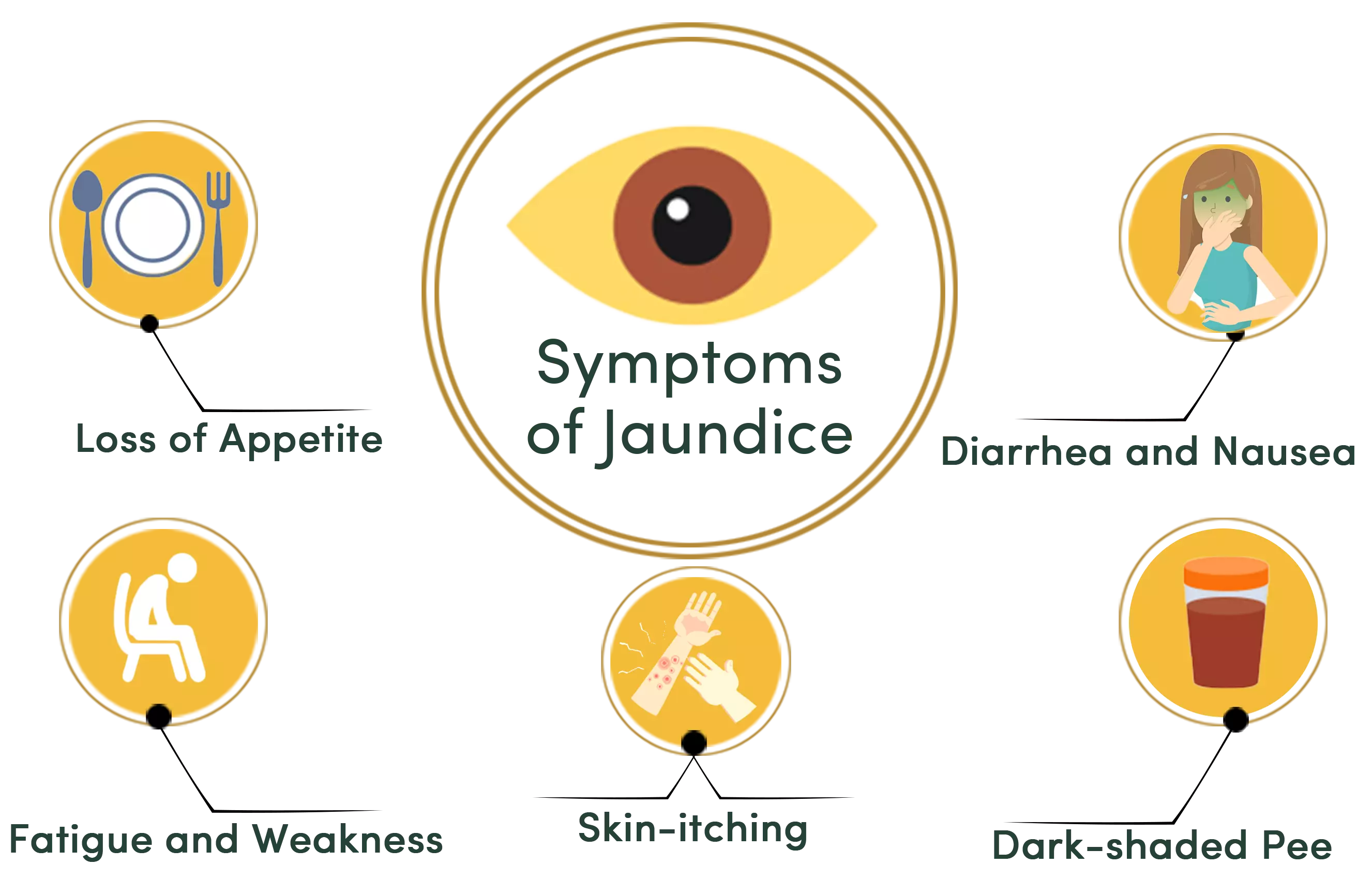 jaundice symptoms