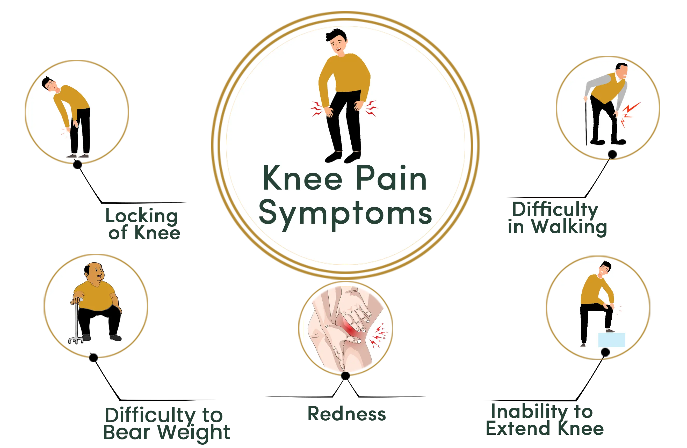 Knee pain symptoms