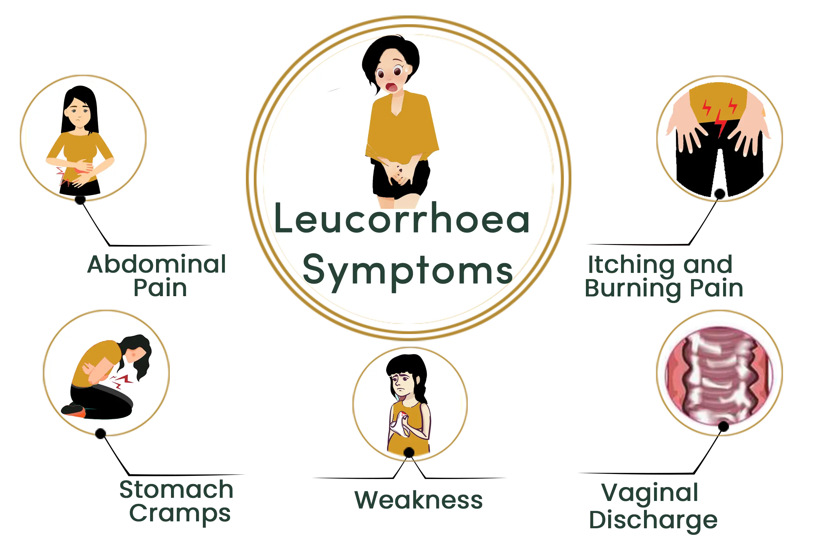 Leucorrhoea symptoms