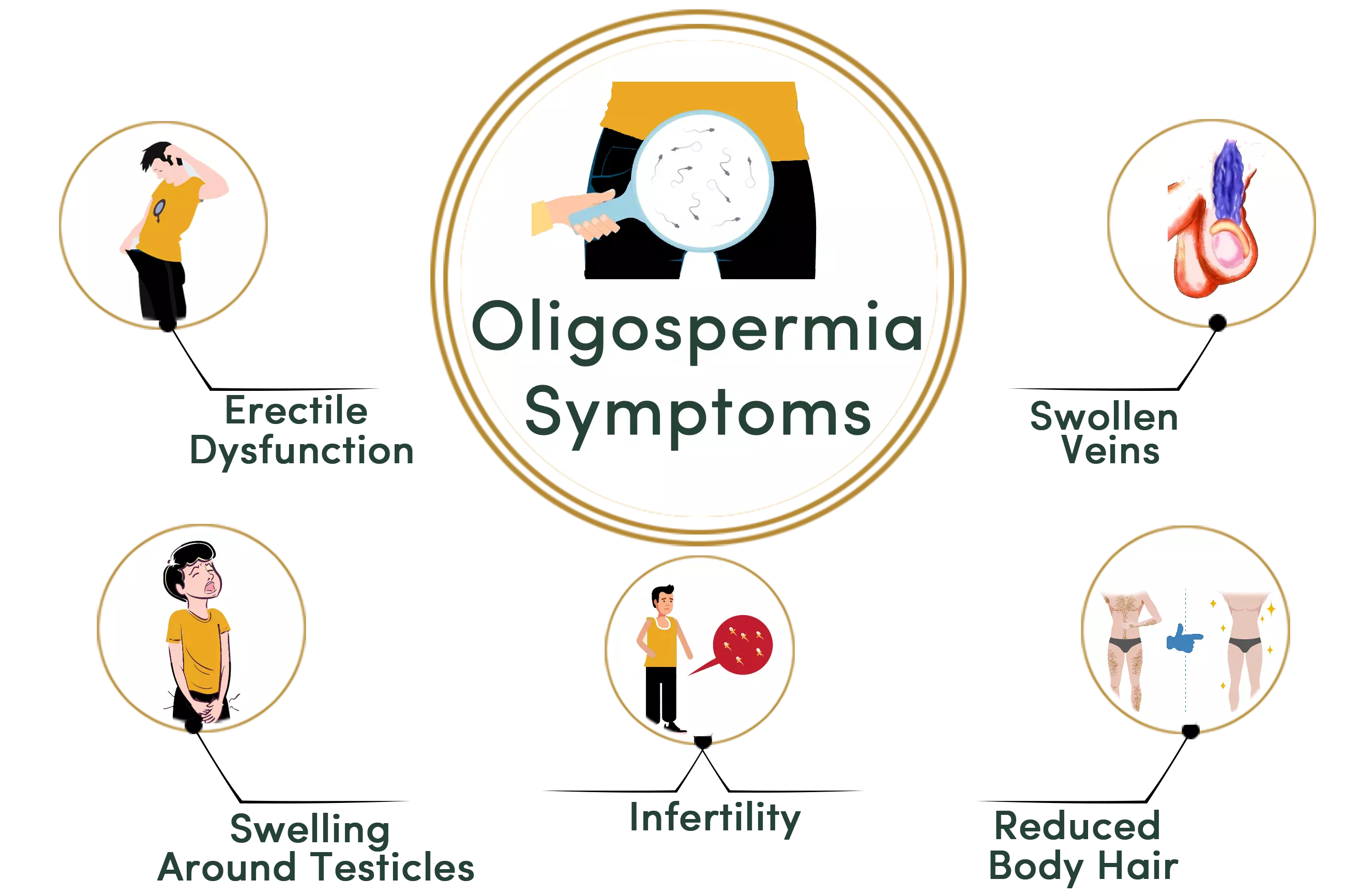 Oligospermia symptoms