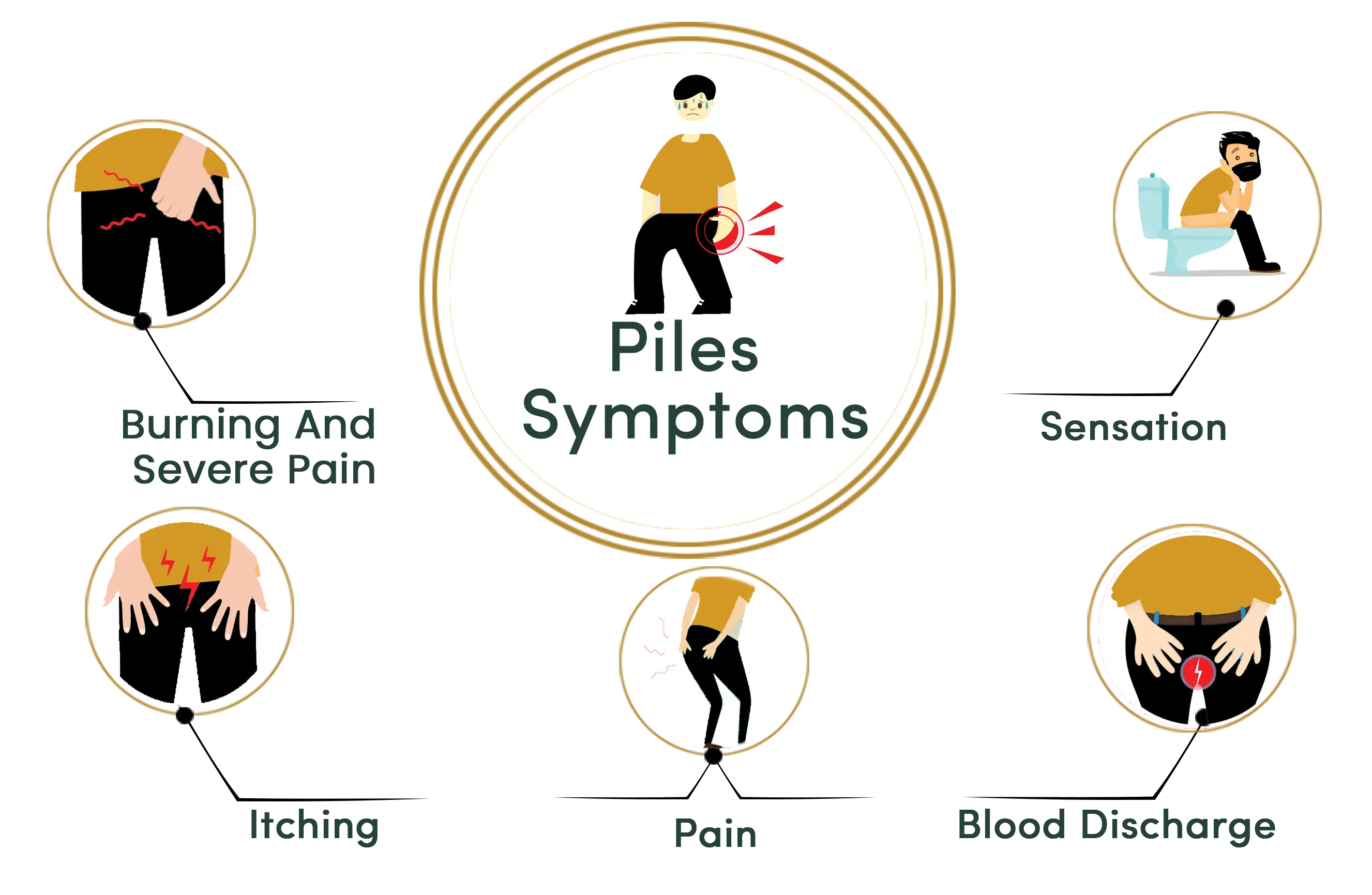 Piles symptoms