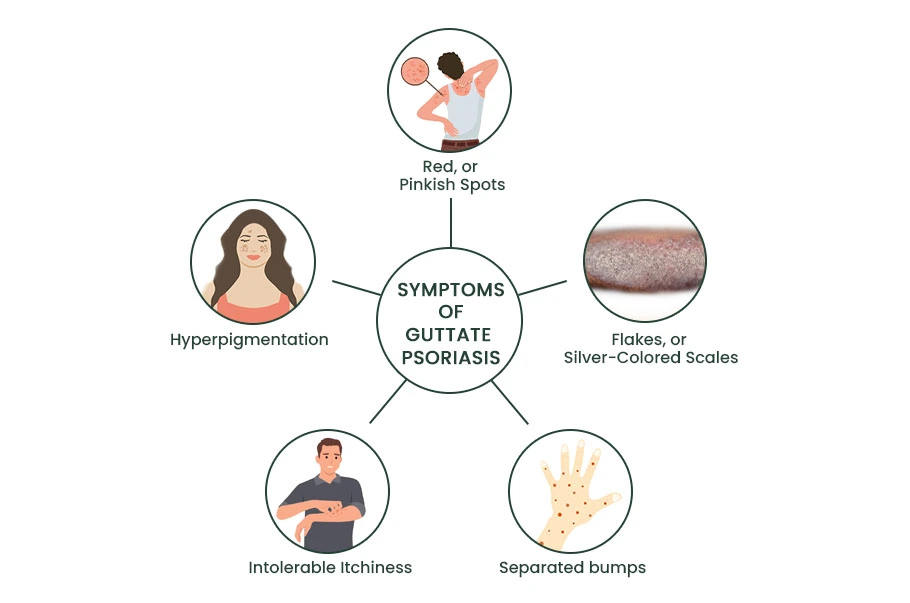 symptoms of eczema