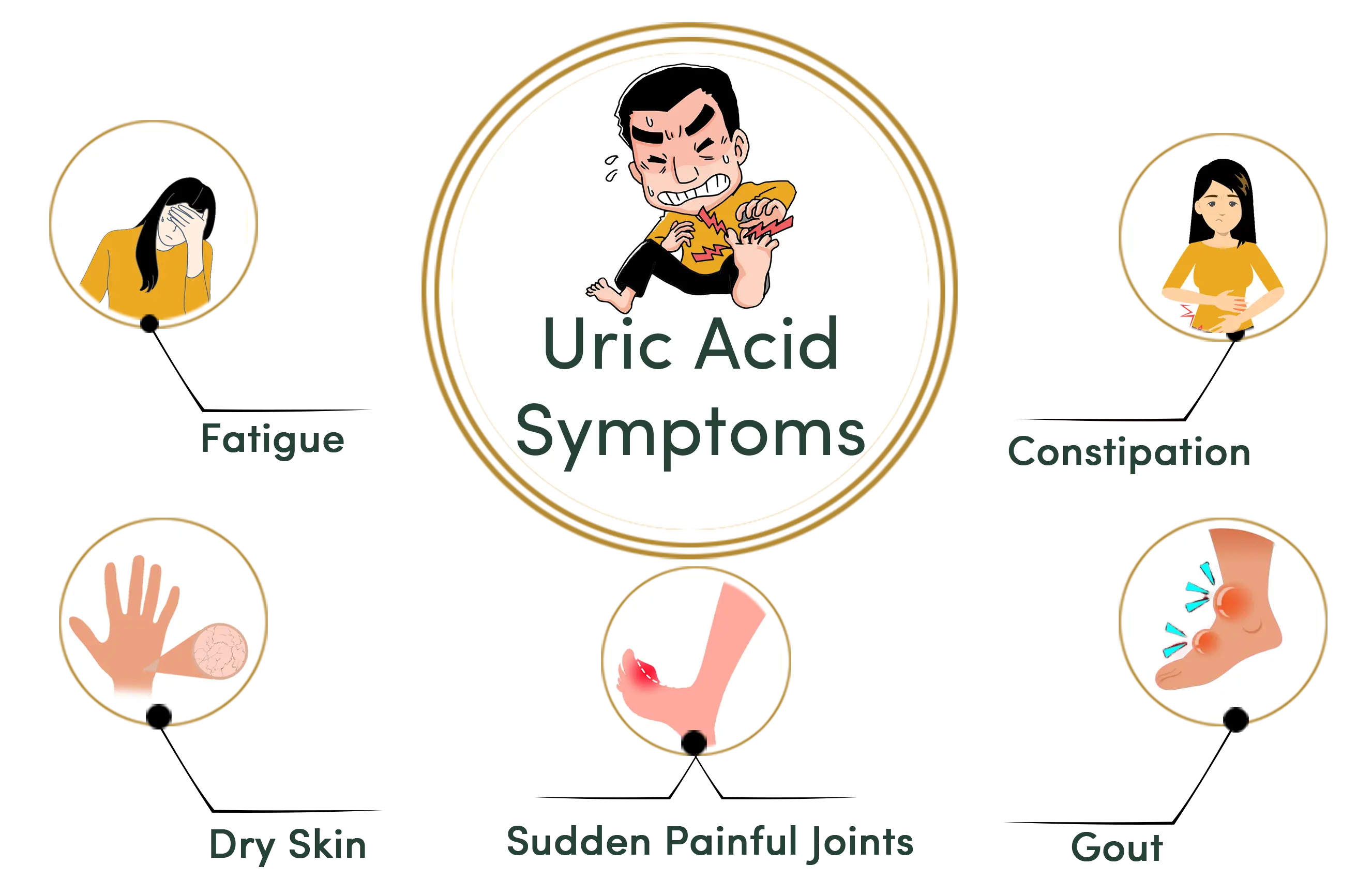 uric-acid-symptoms