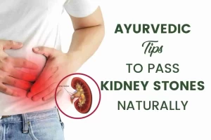 How to Pass Kidney Stones Naturally: 7 Ayurvedic Tips