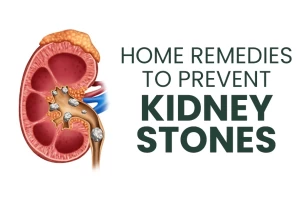 Adopt these 7 Home Remedies for Easy Prevention From Kidney Stones