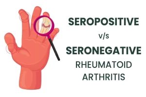 Seropositive v/s Seronegative Rheumatoid arthritis. How does Dr. Sharda Ayurveda treat these?