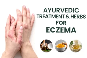 Eczema and the natural way to treat this condition. Know the Ayurvedic herbs for relief