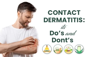 Dealing with Contact dermatitis: know its Do’s and Dont’s