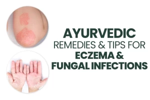 Ayurvedic Remedies and Tips For Eczema And Fungal Infections