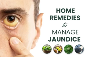 Home remedies to manage Jaundice Recommended by expert