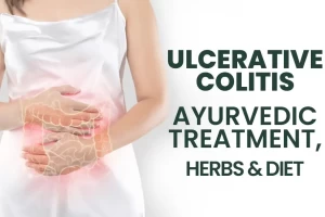 Everything you need to know about Ulcerative colitis