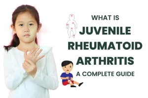 What is Juvenile Rheumatoid Arthritis: A Complete Guide