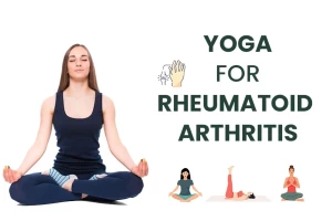 Yoga Asanas for Rheumatoid Arthritis: A Stepwise Guide